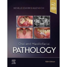 Oral and Maxillofacial Pathology 5e