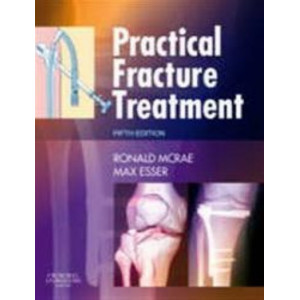 Practical Fracture Treatment 5E