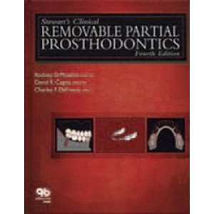 Stewart's Clinical Removable Partial Prosthodontics 4E