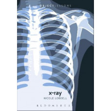 X-ray